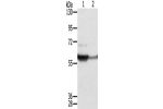 Gel: 8%SDS-PAGE, Lysate: 40 