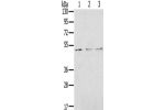 Gel: 8%SDS-PAGE, Lysate: 40 