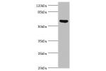 Western blot<br />
All lanes:Muellerian-inhibiting factor antibody at 2ug/ml+mouse small intestine tissue<br />
Secondary<br />
Goat polyclonal to rabbit at 1/10000 dilution<br />
Predicted band size: 59kDa<br />
Observed band size: 59kDa<br />