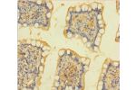 Immunohistochemistry of paraffin-embedded human small intestine tissue using CSB-PA12659A0Rb at dilution 1:100