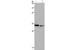 Gel: 8%SDS-PAGE, Lysate: 40 