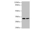 All lanes: Fibroblast growth factor 2 antibody at 2ug/ml<br />
Lane 1:mouse kidney tissue<br />
Lane 2:mouse brain tissue<br />
Secondary<br />
Goat polyclonal to rabbit at 1/10000 dilution<br />
Predicted band size: 31,23,18,22 kDa<br />
Observed band si