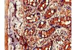 Immunohistochemistry of paraffin-embedded human small intestine tissue using CSB-PA12869A0Rb at dilution of 1:100