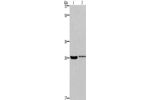 Gel: 8%SDS-PAGE, Lysate: 40 