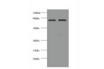 All lanes: Cadherin-12 antibody at 2ug/ml<br />
Lane 1 : EC109 whole cell lysate<br />
Lane 2 : 293T whole cell lysate<br />
Secondary<br />
Goat polyclonal to rabbit IgG at 1/10000 dilution<br />
Predicted band size: 89,85 kDa<br />
Observed band size: 8