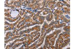 The image on the left is immunohistochemistry of paraffin-embedded Human brain tissue using CSB-PA131441(ALG9 Antibody) at dilution 1/60, on the right is treated with fusion protein. (Original magnification: 