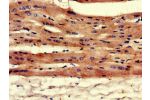 Immunohistochemistry of paraffin-embedded human heart tissue using CSB-PA13149A0Rb at dilution of 1:100