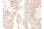 Immunohistochemistry of paraffin-embedded human lung tissue using CSB-PA13179A0Rb at dilution 1:50