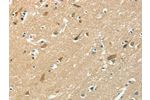 The image on the left is immunohistochemistry of paraffin-embedded Human brain tissue using CSB-PA133826(ASAH2 Antibody) at dilution 1/50, on the right is treated with fusion protein. (Original magnification: 