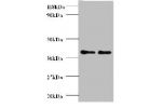All lanes: Cadherin-12 antibody at 2ug/ml<br />
Lane 1 : EC109 whole cell lysate<br />
Lane 2 : 293T whole cell lysate<br />
Secondary<br />
Goat polyclonal to rabbit IgG at 1/10000 dilution<br />
Predicted band size: 39kDa<br />
Observed band size: 39kDa