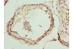 Immunohistochemistry of paraffin-embedded human testis tissue using CSB-PA13569A0Rb at dilution of 1:100
