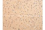 The image on the left is immunohistochemistry of paraffin-embedded Human brain tissue using CSB-PA136284(ATIC Antibody) at dilution 1/25, on the right is treated with fusion protein. (Original magnification: 