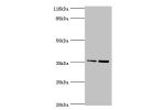 Western blot<br />
All lanes:CFHR2 antibody at 2ug/ml<br />
Lane 1:Hela whole cell lysate<br />
Lane 2:293T whole cell lysate<br />
Goat polyclonal to rabbit at 1/10000 dilution<br />
Predicted band size: 31,28 kDa<br />
Observed band size: 36 kDa<br />