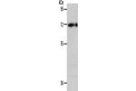 Gel: 10%SDS-PAGE, Lysate: 40 