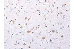 The image on the left is immunohistochemistry of paraffin-embedded Human brain tissue using CSB-PA138502(CCKAR Antibody) at dilution 1/20, on the right is treated with synthetic peptide. (Original magnification: 
