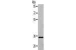 Gel: 10%SDS-PAGE, Lysate: 30 