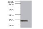 Western blot<br />
All lanes: GTPase ERas antibody at 2ug/ml+293T whole cell lysate<br />
Secondary<br />
Goat polyclonal to Rabbit IgG at 1/10000 dilution<br />
Predicted band size: 26kDa<br />
Observed band size: 26 kDa<br />