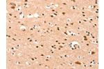 The image on the left is immunohistochemistry of paraffin-embedded Human brain tissue using CSB-PA140877(BAZ1A Antibody) at dilution 1/25, on the right is treated with synthetic peptide. (Original magnification: 