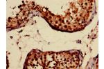 Immunohistochemistry of paraffin-embedded human testis tissue using CSB-PA14169A0Rb at dilution of 1:100