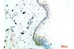 Immunohistochemical analysis of paraffin-embedded human-skin, antibody was diluted at 1:200