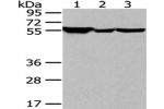 Gel: 8%SDS-PAGE, Lysate: 40 