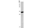 Gel: 6%SDS-PAGE, Lysate: 40 