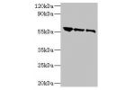Western blot<br />
All lanes:Rabies virus Glycoprotein G antibody at 1:500<br />
Lane 1:Rabies virus antigen 1:2<br />
Lane 2:Rabies virus antigen 1:10<br />
Lane 3:Rabies virus antigen 1:20<br />
Secondary<br />
Goat polyclonal to rabbit at 1/10000 dilut