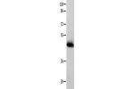 Gel: 10%SDS-PAGE, Lysate: 60 