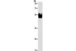 Gel: 8%SDS-PAGE, Lysate: 100 