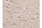 The image on the left is immunohistochemistry of paraffin-embedded Human brain tissue using CSB-PA151388(DLG2 Antibody) at dilution 1/35, on the right is treated with synthetic peptide. (Original magnification: 