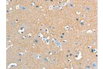 The image on the left is immunohistochemistry of paraffin-embedded Human brain tissue using CSB-PA154092(ADD2 Antibody) at dilution 1/20, on the right is treated with fusion protein. (Original magnification: 