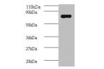 Western blot<br />
All lanes: Avpr1a antibody at 2ug/ml+mouse spleen tissue<br />
Secondary<br />
Goat polyclonal to Rabbit IgG at 1/10000 dilution<br />
Predicted band size: 84 kDa<br />
Observed band size: 84 kDa<br />