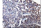 The image on the left is immunohistochemistry of paraffin-embedded Human tonsil tissue using CSB-PA159155(BIRC5 Antibody) at dilution 1/15, on the right is treated with fusion protein. (Original magnification: 