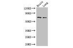 Western Blot<br />
Positive WB detected in:Mouse brain tissue,Mouse lung tissue<br />
All lanes: FOXO1 antibody at 2.5ug/ml<br />
Secondary<br />
Goat polyclonal to rabbit IgG at 1/50000 dilution<br />
Predicted band size: 70 kDa<br />
Observed band size: