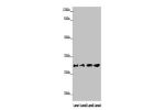 Western blot<br />
All lanes: AQP1 antibody at 16ug/ml<br />
Lane 1 : Rat heart tissue<br />
Lane 2 : Mouse skeletal muscle tissue<br />
Lane 3 : A549 whole cell lysate<br />
Lane 4 : 293T whole cell lysate<br />
Secondary<br />
Goat polyclonal to rabbit 