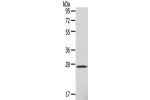 Gel: 10%SDS-PAGE,Lysate: 40 