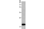 Gel: 10%SDS-PAGE,Lysate: 40 