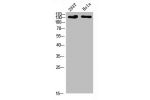 Western Blot analysis of 293T Hela cells using Collagen I Polyclonal Antibody diluted at 1:500. Secondary antibody  was diluted at 1:20000