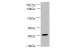Western blot<br />
All lanes: Rat Brain-derived neurotrophic factorntibody at 2/ml+U251 whole cell lysate<br />
Secondary<br />
Goat polyclonal to Rabbit IgG at 1/10000 dilution<br />
Predicted band size: 28 kDa<br />
Observed band size: 28 kDa<br />