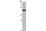Gel: 8%SDS-PAGE,Lysate: 40 