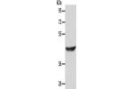 Gel: 10%SDS-PAGE, Lysate: 40 