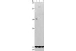 Gel: 12%SDS-PAGE, Lysate: 50 