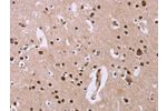 The image on the left is immunohistochemistry of paraffin-embedded Human brain tissue using CSB-PA168510(ANLN Antibody) at dilution 1/20, on the right is treated with fusion protein. (Original magnification: 