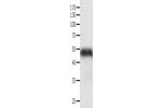 Gel: 10%SDS-PAGE, Lysate: 40 