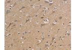 The image on the left is immunohistochemistry of paraffin-embedded Human brain tissue using CSB-PA171419(CCR2 Antibody) at dilution 1/20, on the right is treated with synthetic peptide. (Original magnification: 