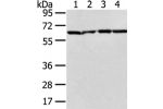 Gel: 6%SDS-PAGE, Lysate: 40 