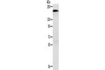 Gel: 6%SDS-PAGE, Lysate: 40 