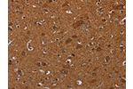 The image on the left is immunohistochemistry of paraffin-embedded Human brain tissue using CSB-PA176464(CYBB Antibody) at dilution 1/40, on the right is treated with synthetic peptide. (Original magnification: 