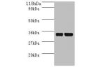 Western blot<br />
All lanes: dcyD antibody at 2ug/ml+DH5a whole cell lysate<br />
Secondary<br />
Goat polyclonal to Rabbit IgG at 1/10000 dilution<br />
Predicted band size: 35kDa<br />
Observed band size: 35 kDa<br />