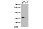 Western Blot<br />
Positive WB detected in:Rosseta bacteria lysate at 40